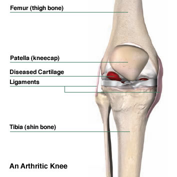 Anatomical Knee Joint Key Ring Keychain Femur Tibia 